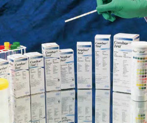 Harn-Teststreifen Geräte