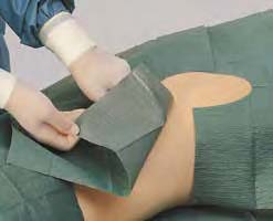 lochtuch_selbstklebend_variabel_raucodrape