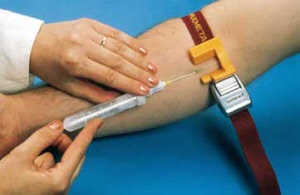 praemeta_easy_stauer_fuer_problemvenen