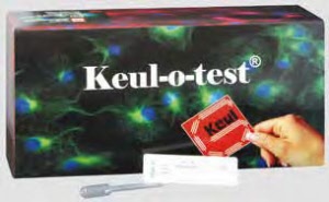 psa_keul_o_test_kassettentest