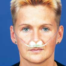 sauerstoffbrille_soft