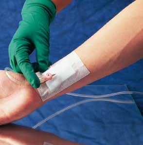 servoderm_i_v_pflaster