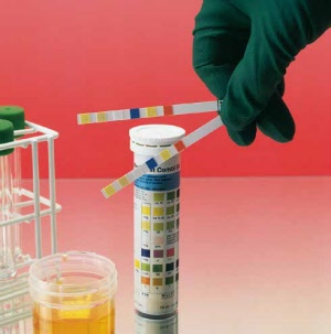 servotest_diagnosestreifen_urindiagnose1